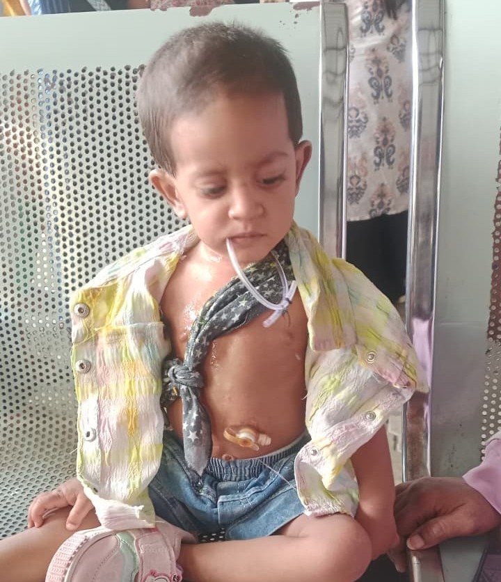 Ayzaal Nadeem Shaikh Throat Surgery